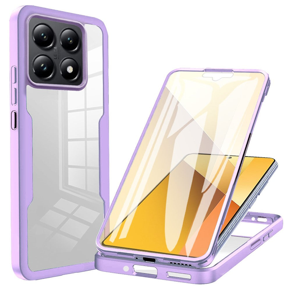 For Xiaomi 14T Case Acrylic+TPU Clear Phone Cover with PET Screen Film
