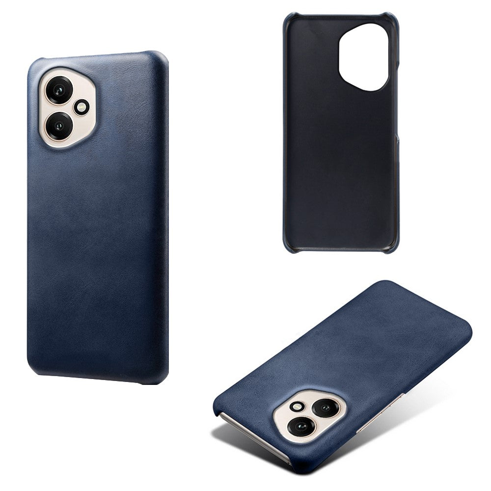 For Honor 400 5G (Global) Case Calf Texture PU Leather Hard PC Protective Phone Cover